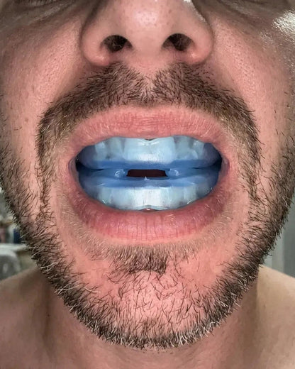 Vitéa™ Gouttière Anti-Ronflement Silencieuse Taille Universelle